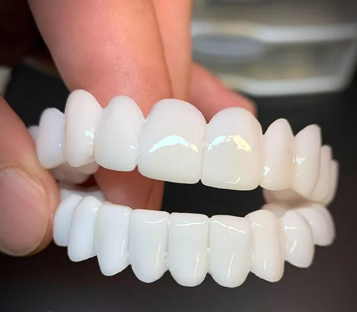 SmileFit - Realistisch tand model Dentist beugels voor natuurlijk comfort en eenvoudig gebruik